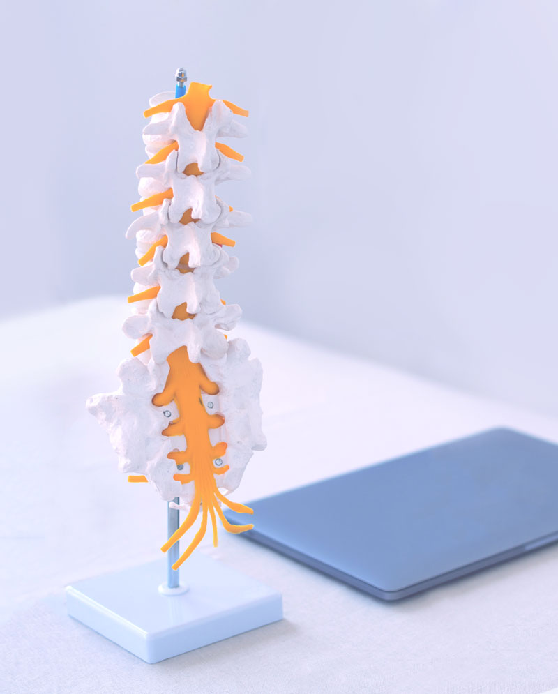 Spinal treatment model showing vertebrae and disc alignment at Lombardi Chiropractic